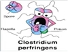 عفونت Clostridium perfringens (جوانه کافه تریا)